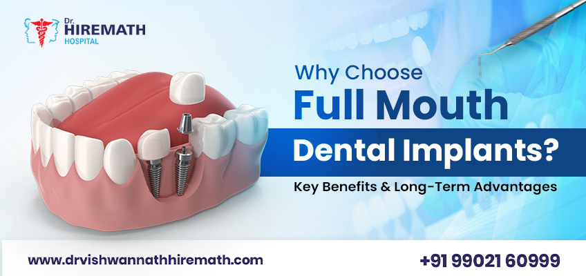 full-mouth-dental-implants-benefits-types-cost-procedure